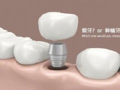佛山市2025年比较好的牙齿矫正医院，哪家专业可信赖？