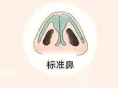 石家庄美莱隆鼻整形隆鼻实例和医院整形项目价格分享