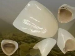 天津种植牙医院推荐，8家医院风格、价格大不同供参考！