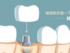 东莞市内优质口腔医院排行榜！宜居环境与先进技术并存的公私牙科推荐