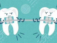 无锡第二人民医院牙齿矫正怎么样？医院资料分享&牙齿矫正术后反馈