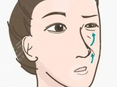 厦门华美整形价格表,陈运生隆鼻案例果对比图分享~