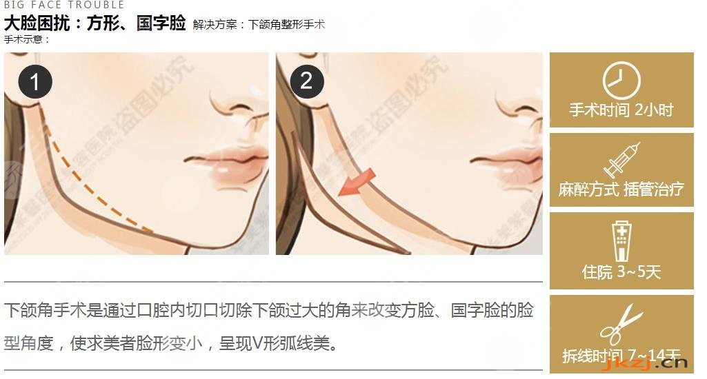 磨骨知识科普
