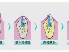 昆明市五家好评如潮的口腔医院盘点