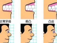 昆明口腔医院推荐10家实力强口碑好的价格亲民