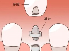 昆明地区口腔医院优选评析，服务实力与收费标准一览！