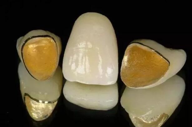 福州专业牙科医院医学排名霸主浮出水面，三家机构引领潮流