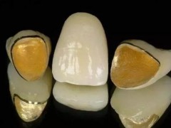 福州专业牙科医院医学排名霸主浮出水面，三家机构引领潮流