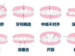 温州牙齿矫正哪家医院好？前5名医院榜单分享~任你选择！