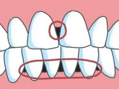 常州补牙价格多少？了解技术和材料的影响！