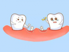 石家庄牙齿矫正费用大概多少？牙齿矫正方式哪种好？