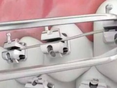 石家庄牙齿矫正哪家医院是比较好的选择？2025年医院榜单公布！