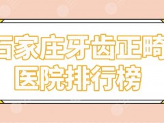 石家庄牙齿正畸医院排行榜|矫正哪家医院好？中诺、威迩、冀城口腔上榜！