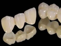 泉州牙齿种植医院：解决牙齿问题的专家盘点