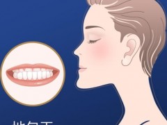 泉州哪家牙科医院好评如潮，排名靠前？听听网友怎么说！