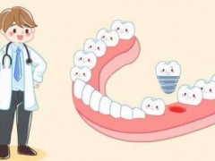 贵阳种一颗牙大概要多少钱？价格因素/优势盘点