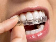 嘉兴哪家医院进行牙齿矫正整形比较好？丰富矫正方法满足不同需求