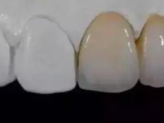 太原地区优质牙科机构推荐，口碑极佳的正规口腔医院有哪些？