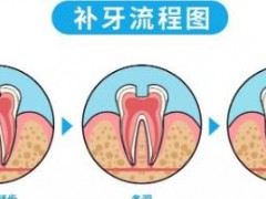 徐州地区牙齿矫正医院TOP 5！专业推荐，德贝、美奥价格公开！
