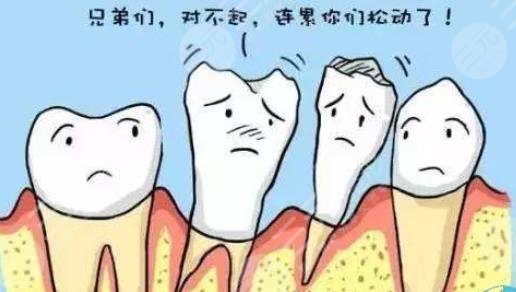 牙齿种植是什么原理
