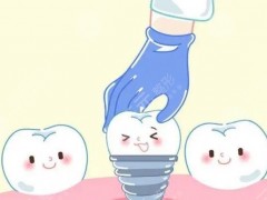 珠海市第二人民医院种植牙价格是怎样的？医生介绍&价格详情 感兴趣来看看~