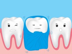 宁波补牙一般多少钱一颗？价格费用？牙齿护理很重要`来看看如何护理吧！